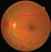 Iris Recognition vs Retinal Is there Difference?
